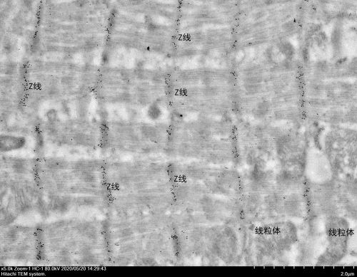 抗體費(免疫電鏡)