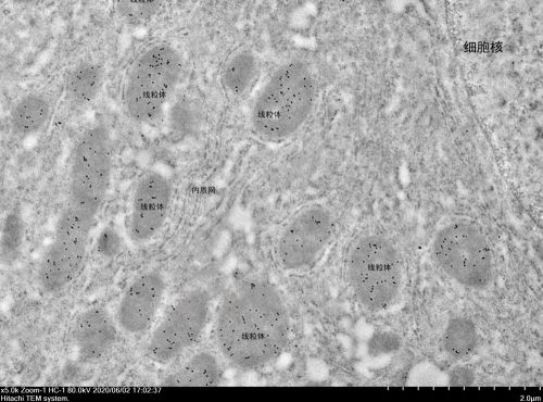 超薄切片(鎳網)