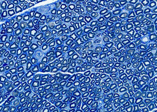 半薄切片甲苯胺藍染色