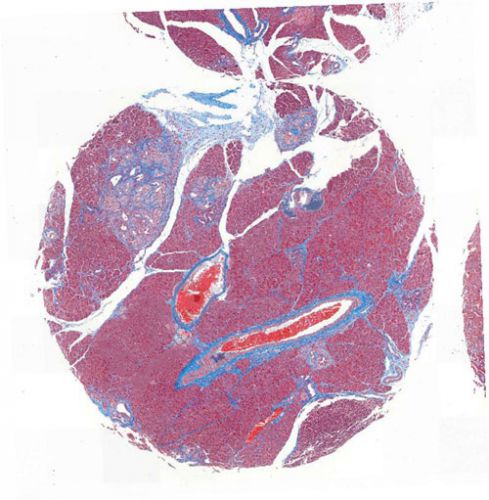 特染芯片AI分析（面積）
