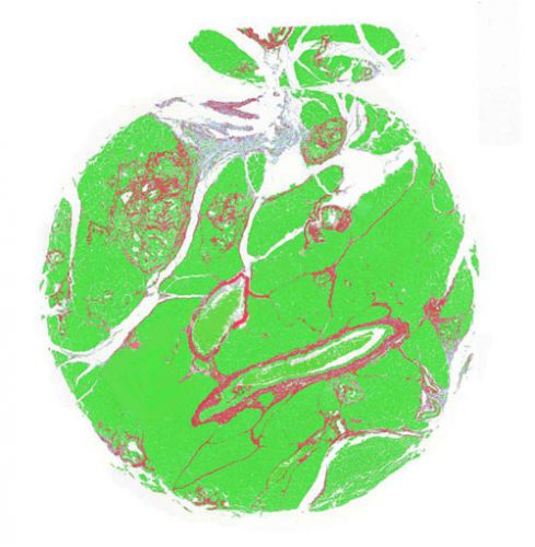 特染芯片AI分析（面積）