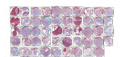 特染芯片AI分析（面積）