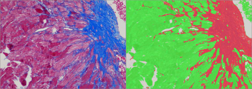 特染切片AI分析（面積）