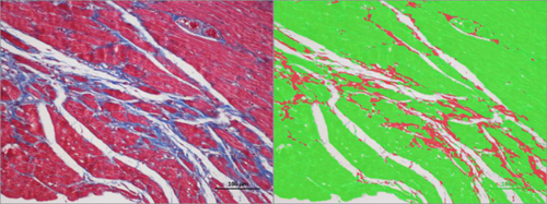 特染切片AI分析（面積）