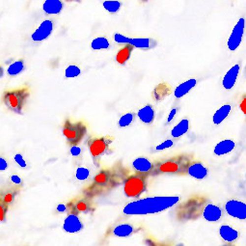 IHC芯片AI分析（個數(shù)）