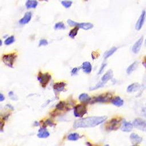 IHC芯片AI分析（個數(shù)）