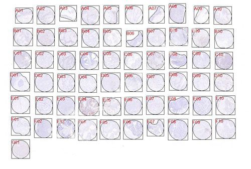 IHC芯片AI分析（個數(shù)）