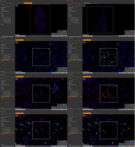 熒光分析（普通切片數字掃描）