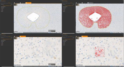 組化分析（普通切片數字掃描）