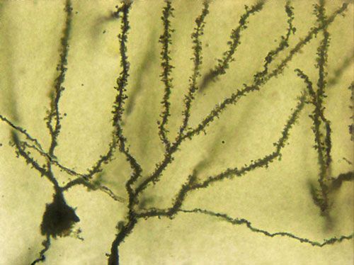 拍照（景深擴(kuò)展）