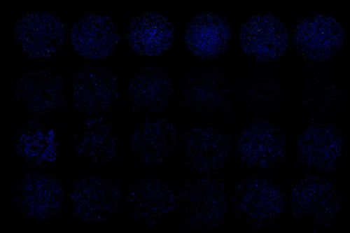 TUNEL（細胞芯片）檢測
