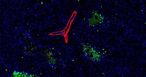 IF TUNEL雙染檢測