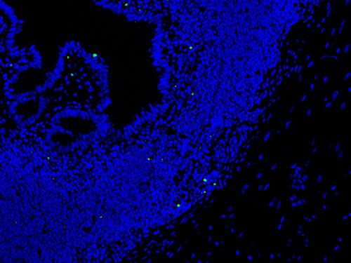 TUNEL（熒光）檢測