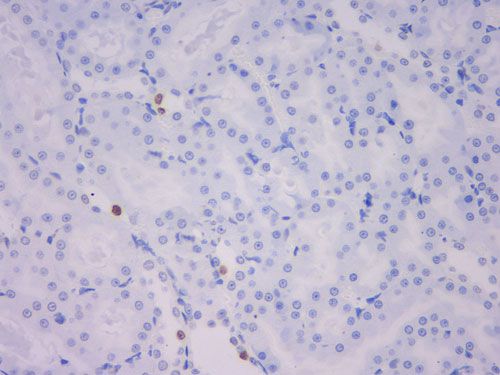 TUNEL（白光）檢測