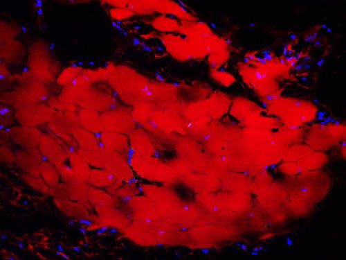 尼羅紅染色（動(dòng)物標(biāo)本）