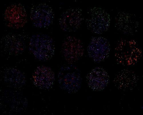 免疫熒光（雙標(biāo)，細(xì)胞芯片）