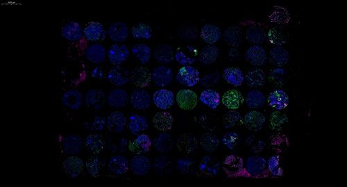 組織芯片免疫熒光三標(biāo)