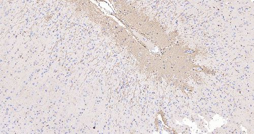 免疫組化（大組織）