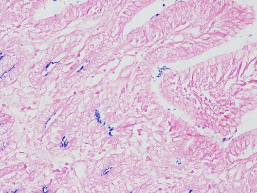 快速革蘭氏染色