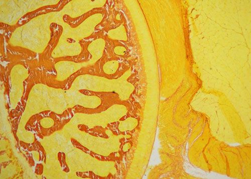 未脫鈣骨Van Gieson染色