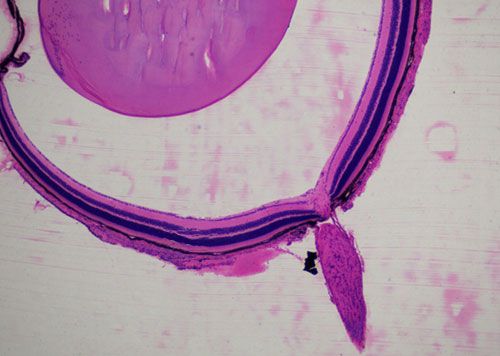 未脫鈣骨HE染色