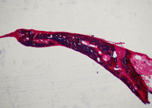 未脫鈣骨Masson染色