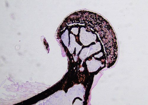 未脫鈣骨von Kossa染色