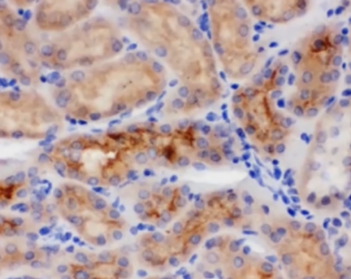 免疫組化IHC染色實(shí)驗(yàn)結(jié)果解讀