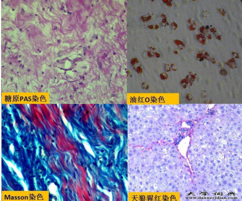 病理特殊染色合集，用途加結(jié)果判讀